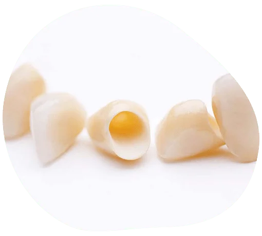 metalokeramičke krunice