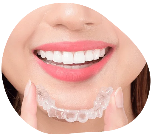 folije za ispravljanje zuba