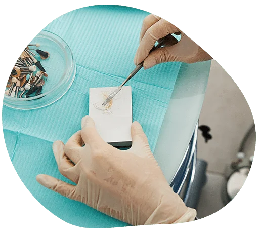 plombiranje zuba cena