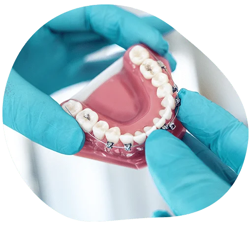 fiksna proteza beograd