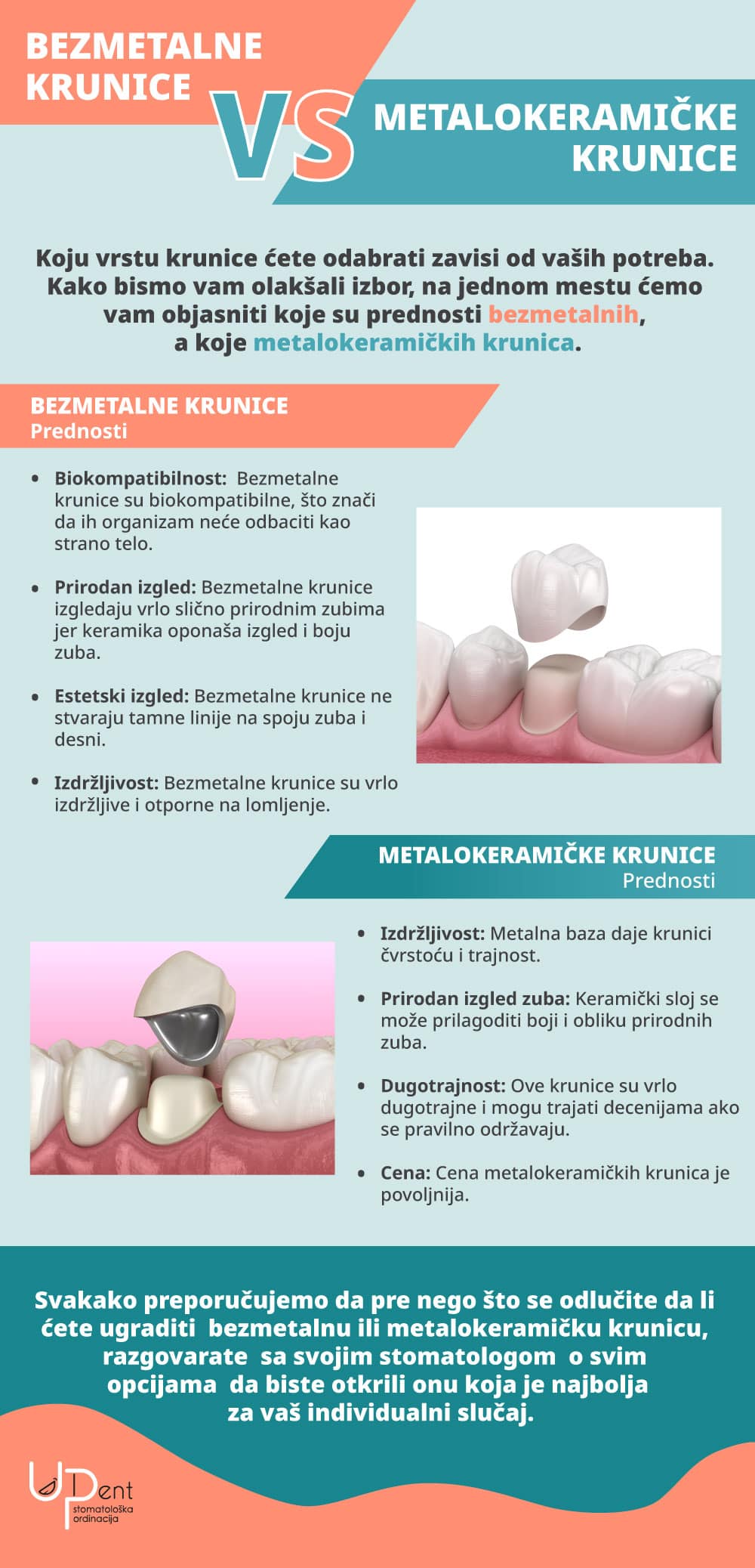 Razlika između metalokeramičkih i bezmetalnih krunica