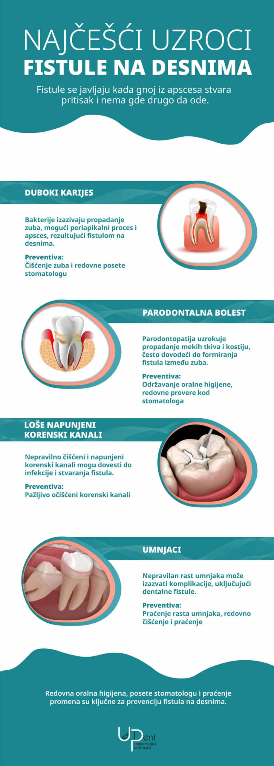 fistule na desnima