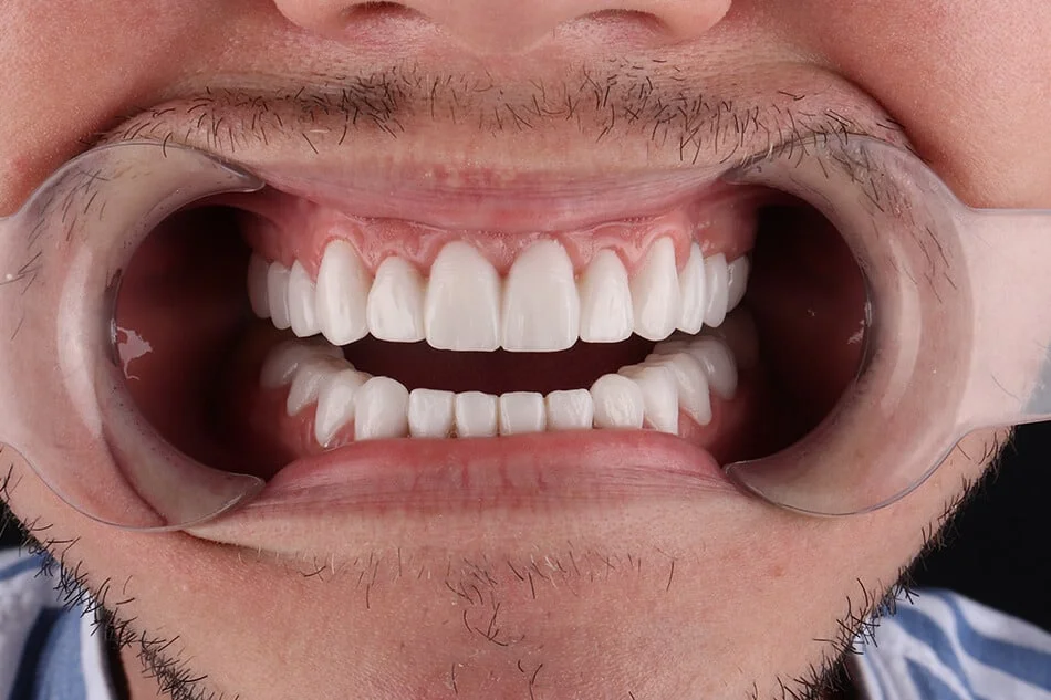 bruno-bezmetalne-posle