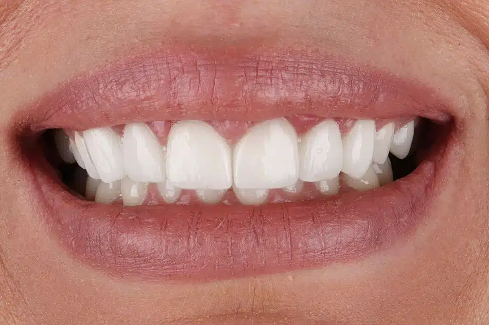 isidora-bezmetalne-posle