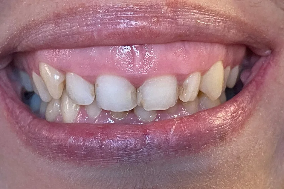 isidora-bezmetalne-pre