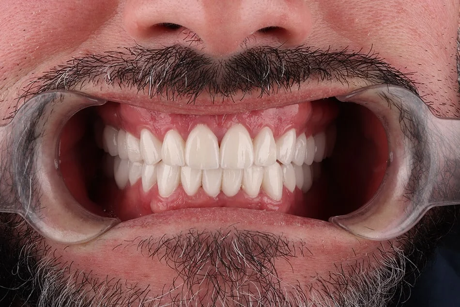 roman-bezmetalne-posle