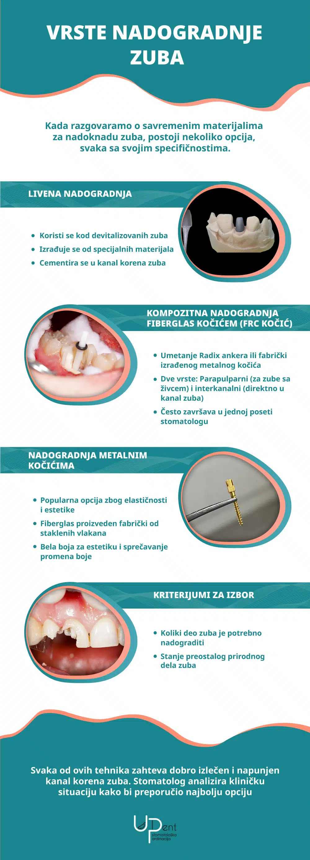 Infografik Vrsta nadogradnje zuba scaled